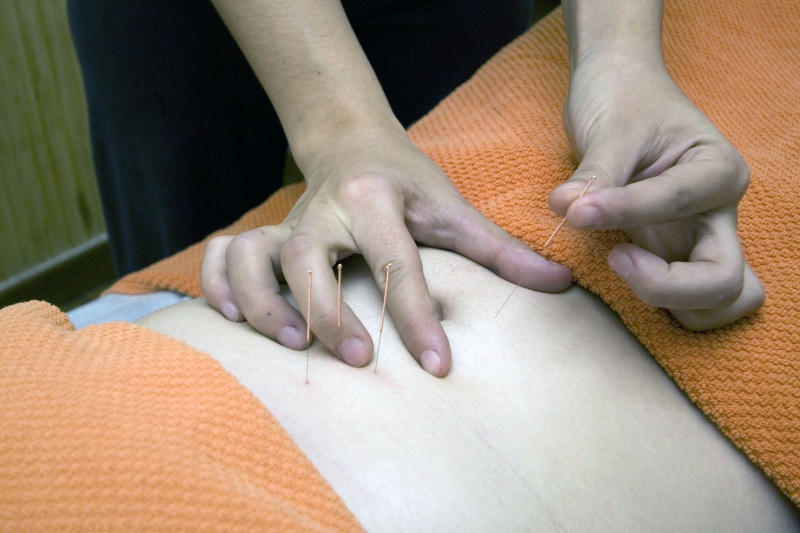 osteopathe-GUILLAUMES-min_acupuncture-4175625